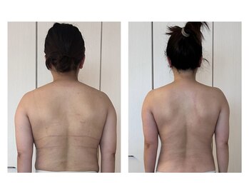 ハートエルボー(Heart elbow)/知らず知らずのうちに丸い背中へ