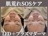 【肌質改善・肌トラブル解消】プラズマダーマ+お悩み別LED照射¥9900