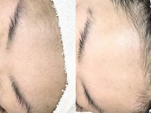 アイラッシュ リュピエス(eyelash ryupiece)