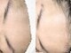 アイラッシュ リュピエス(eyelash ryupiece)の写真