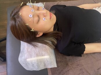 ふなと川接骨院 倉賀野院の写真/【眼精疲労特化コース】部分鍼灸＋お灸2200円♪PC、スマホによる目の疲れやデスクワークの方などに◎