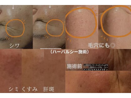 サロンドアモール(Salon de a mole)の写真