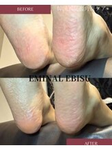 エミナル 横浜(EMINAL)/ペディプランニング