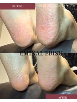 エミナル 横浜(EMINAL)/ペディプランニング