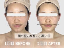 ドクタープラント 北心斎橋店(DR PLANT)の雰囲気（高山植物スキンケア×東洋医学を基にした美容術＊本気の肌質改善）