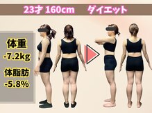 ほんじょう整骨院 美容整体/北九州/八幡西区/ダイエット