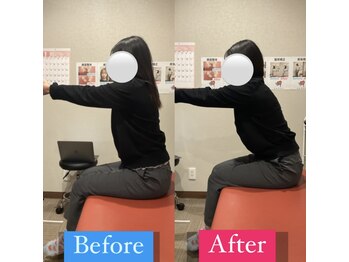 ナオル整体 宮崎院(NAORU整体)/20代女性施術事例【反り腰改善】