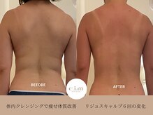 エイム(e.i.m)/30代：痩せにくい/太りやすい