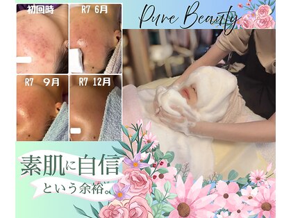 ピュアビューティー(Pure Beauty)の写真