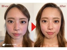 グレースフィオーレ 町田店(gracefiore)/お客様のビフォーアフターその２