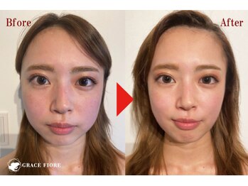 グレースフィオーレ 町田店(gracefiore)/お客様のビフォーアフターその２