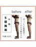 【半身筋膜痩身60分】ハイパーナイフEX＆シェイプ脂肪燃焼