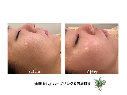 アイティス(Salon Its)の写真