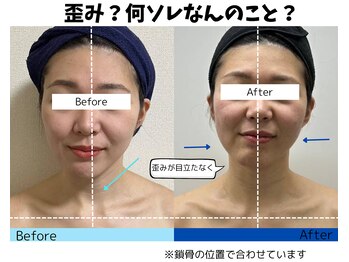 お顔の研究所/ビフォーアフター写真♪