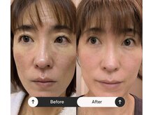 ゆう/光フェイシャルすごい