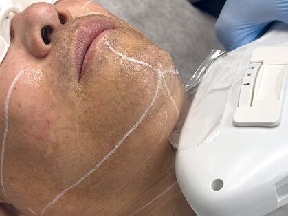 ヘアージュエル ファムファタール(HAIR JEWEL Femme Fatale)の写真