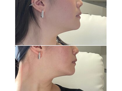 スリーアイ 天王寺店(3EYE)の写真