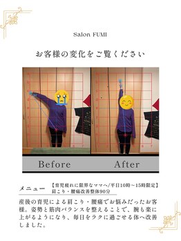 フミ(FUMI)/30代女性施術事例【巻き肩改善】