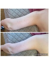 アクアモア/アクアモアの痩身★BeforeAfter