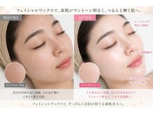 メゾンドエス(Maison de S)の雰囲気（即！艶肌爆誕★）