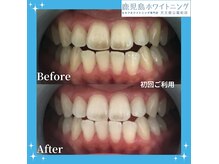 鹿児島ホワイトニングの雰囲気（理想の白さをお届け♪鹿児島/ホワイトニング専門店）
