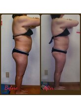 ダイエットルーム リ ボーヌ(Re Bornu)/・50代　全身メディセル16回