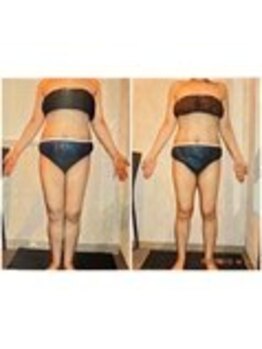 パーフェクトボディプレミアム 渋谷店(PERFECT BODY PREMIUM)/お客様 ビフォーアフター(7)
