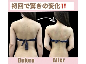 スワン 新栄店(SWAN)/ブライダル/背中美人へ