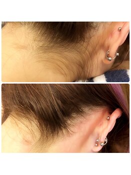 ハレノヒ(HaLeNoHi)/【ブラジリアンワックス】