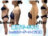 8月限定モニター募集★【脂肪冷却1ヶ月通い放題 】¥264.000→ ¥75.000円