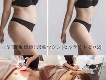ノエル(NOEL)の雰囲気（痩身や深層のコリに効く微弱電流マッサージのボディのメニューも）