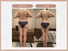 ソウイボディ 川崎本店(Sou-i body)/お客様ビフォーアフター#美脚