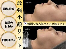 ビズビズ(bizz bizz)