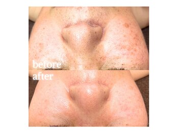 サンティエ(Santie)/たるみ毛穴の開き、シミ、乾燥に