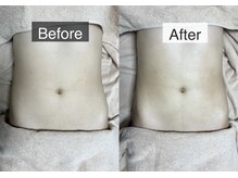 ベルフィーヌ 恵比寿店(BELFINE)/BELFINEオリジナル痩身