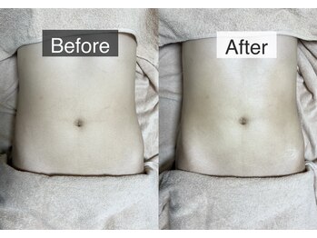 ベルフィーヌ 恵比寿店(BELFINE)/BELFINEオリジナル痩身