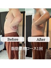 ル ボヌール/メンズ痩身脂肪燃焼コース1回で