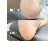 ネイルニニ(Nail22)の雰囲気（驚きと感動！1度でツル スベ フワッずっと触ってたい角質除去）