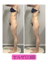 アーク(ARC)/全身痩身120分ビフォーアフター