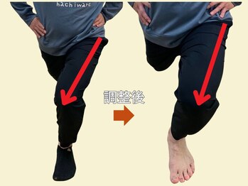 ニコ(niko)/グラグラ改善例