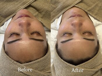 リフコウベ(LIF KOBE)/艶肌wax+ハーブピーリング１回