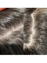 シュール センター南(SURREAL)/ヘッドスパ後のビフォーアフター