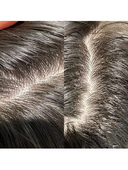 シュール センター南(SURREAL)/ヘッドスパ後のビフォーアフター