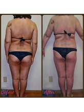 ダイエットルーム リ ボーヌ(Re Bornu)/・50代　全身メディセル16回