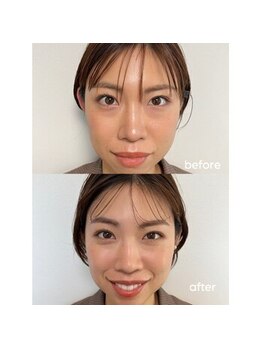ロロサロン(roro salon)/Skin  Makeup【before＆after】
