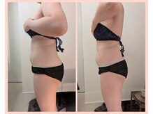 ワイズ(Y's)/お腹１６回目