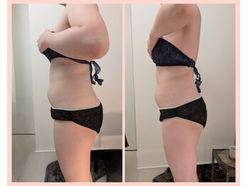 ワイズ(Y's)/お腹１６回目