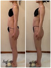 シャルマン(Charmant)/befoer、after