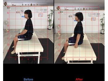 ストレチックス 近江八幡店/姿勢改善ビフォーアフター1回