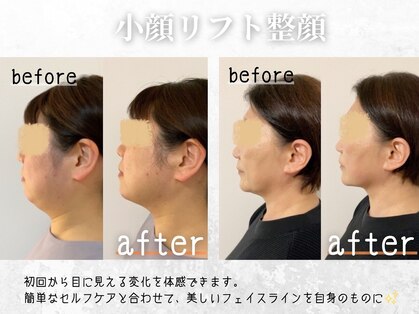 チル(Chill.)の写真